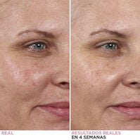 Hello Results Baby-Smooth Glycolic Peel + Caring Oil Sérum  30ml-205821 Hello Results Baby-Smooth Glycolic Peel + Caring Oil Sérum  30ml-205821 3